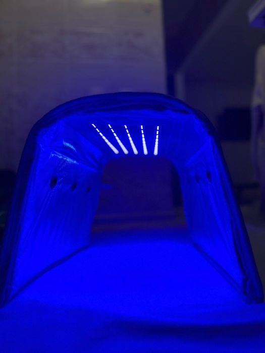 Фотолампа для лечения желтушки новорождённых