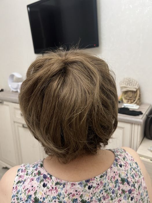 Теменная накладка