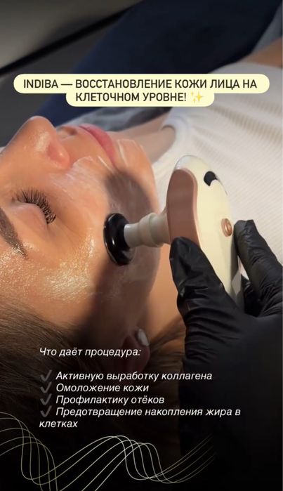 Продам косметологический аппарат INDIBA (RET-терапия)