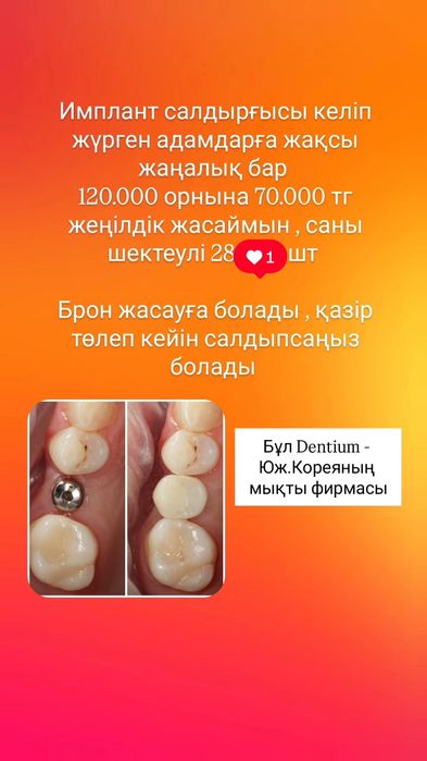 Имплант Dentium Юж.Корея