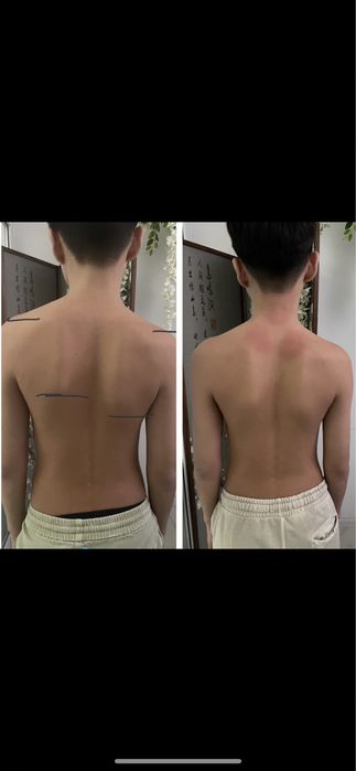 Мануальный терапевт , остеопат