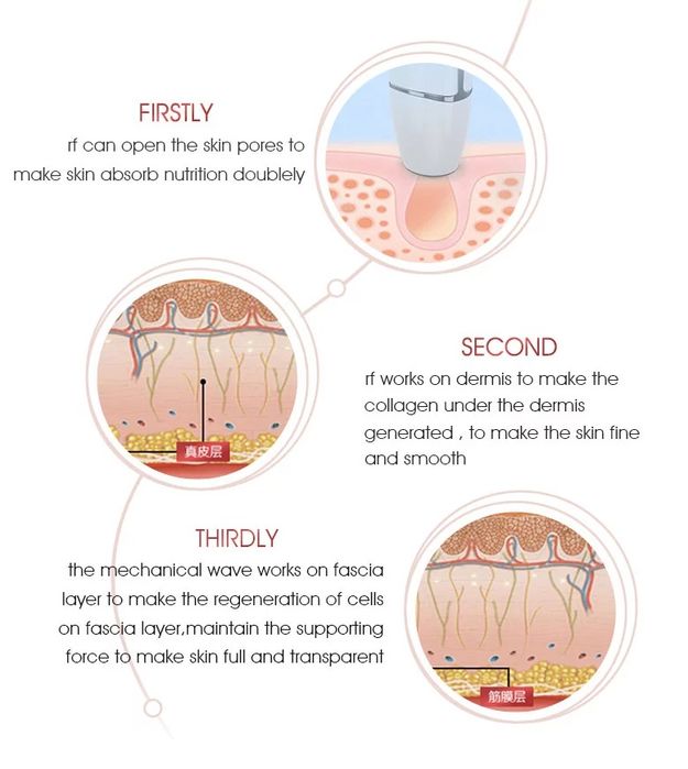 V-max HIFU уред за дълбок лифтинг за домашна употреба