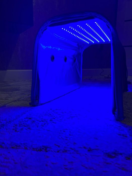 Фотолампы от желтушки