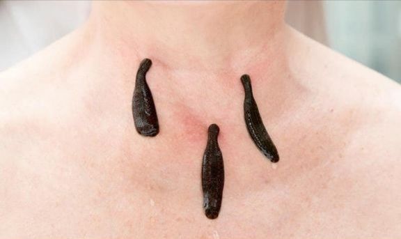 Тиббий ЗУЛУК ОПТОМ нархда