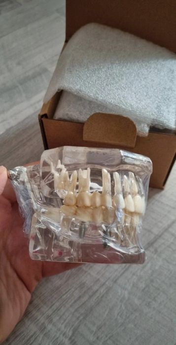 Model dentar multiple patologii
