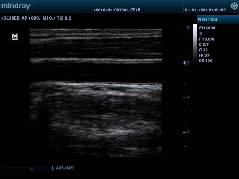Узи Аппарат Mindry DP-10 2025год выпускОфициальный дилер