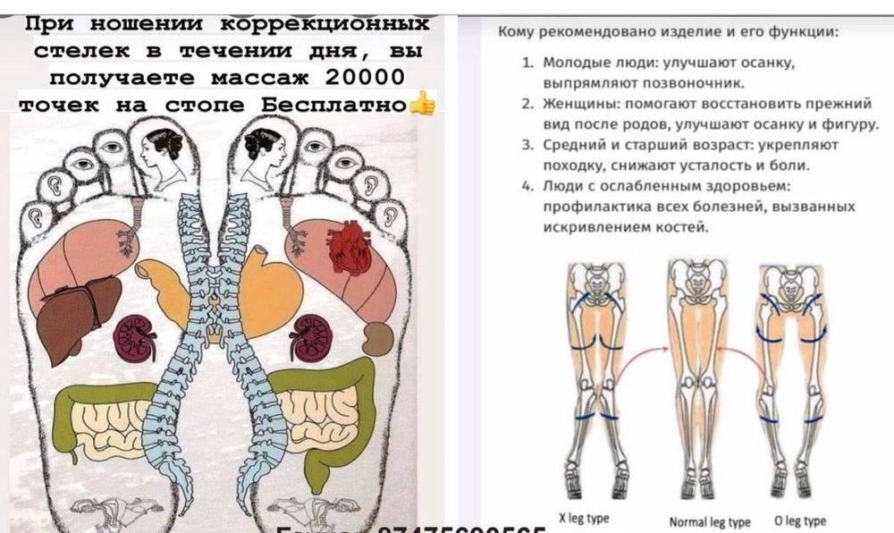 Коррекционные анионовые стельки