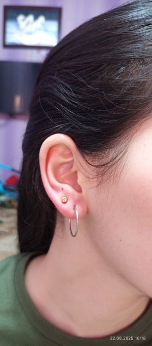 Quloq Burun teshish xizmati endi sizning xonadoningizda