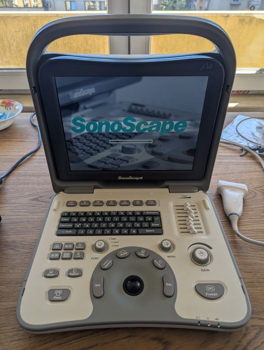 SonoScape A5 – Преносим ехограф с трансдюсер