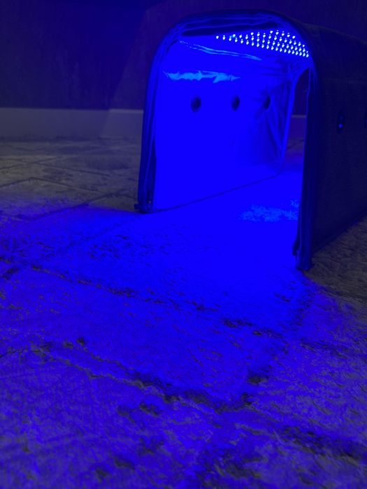 Фотолампы от желтушки