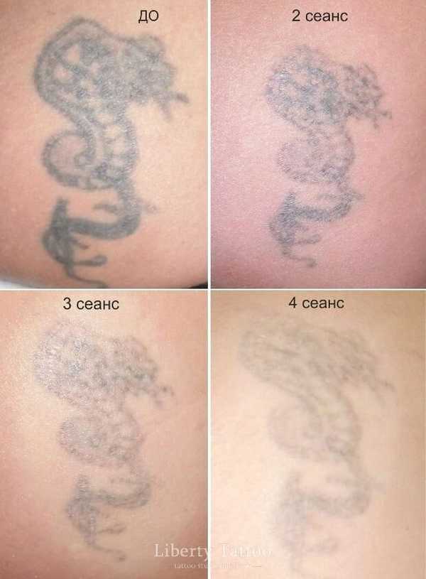 Как заживает тату по дням фото Как заживает тату по дням фото