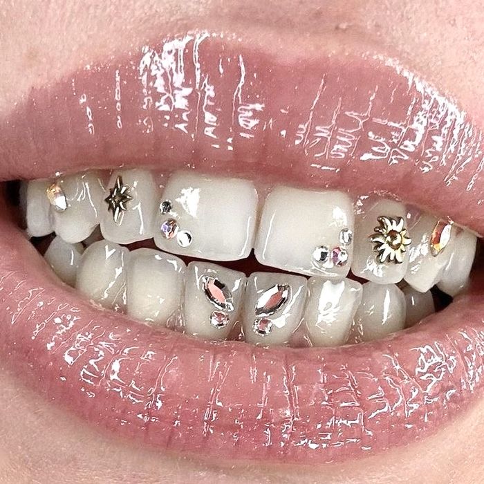 Красивая улыбка уже сегодня | Стоматолог Ташкент