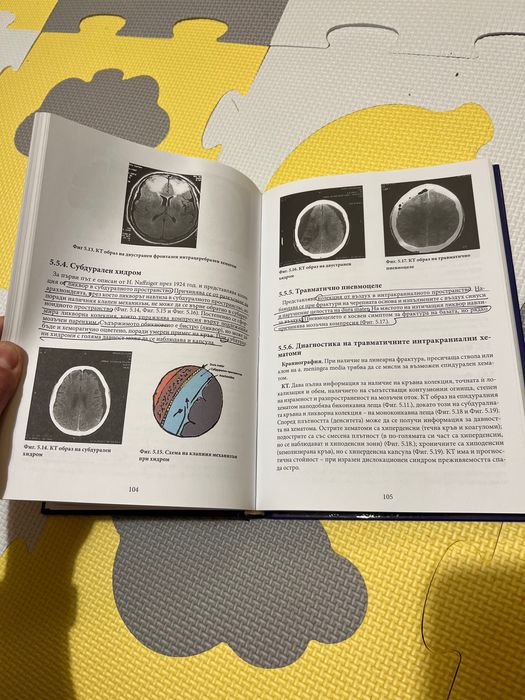 Основи на Неврохирургията - Китов