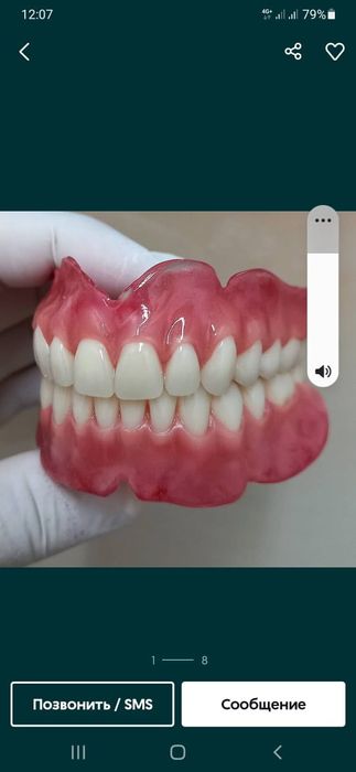 Сьемные Протезирование