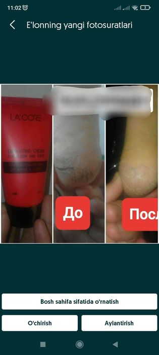 Tovon tirsak oyoq qoʻl yorilishini oldini olib va ulardan xalosboʻlish