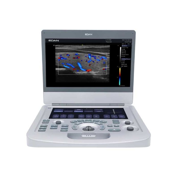 Ультразвуковая диогностическая Система Acclarix AX3