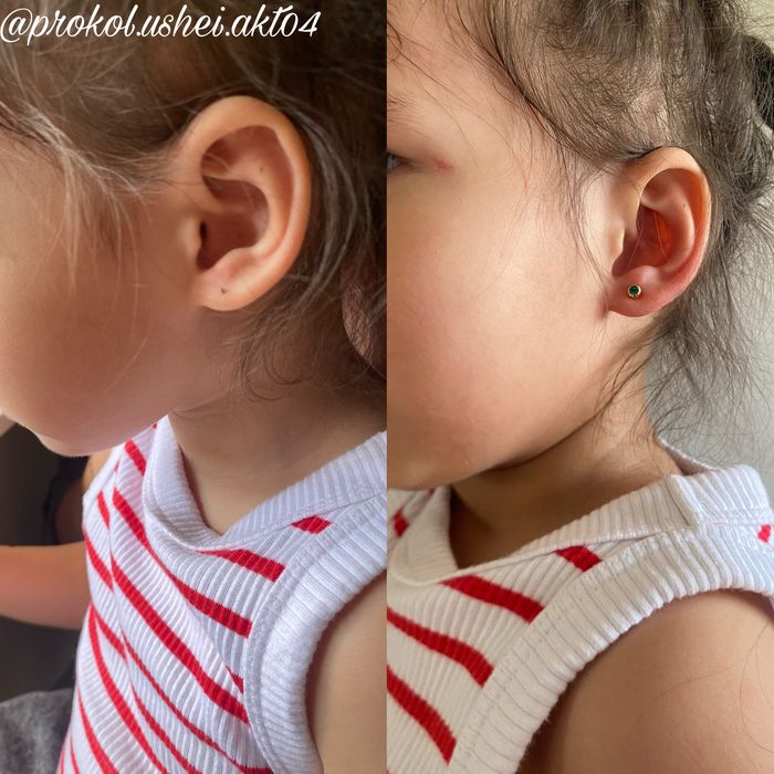 Прокол ушей стадекс
