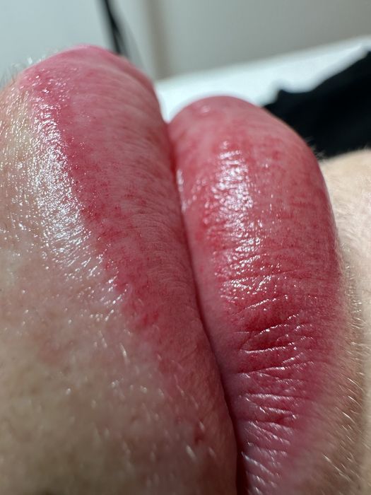 Dermopigmentare buze-500 lei/ sedinta