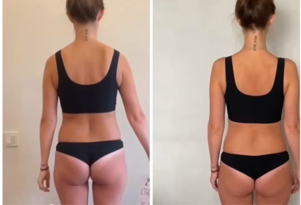 Коррекция фигуры