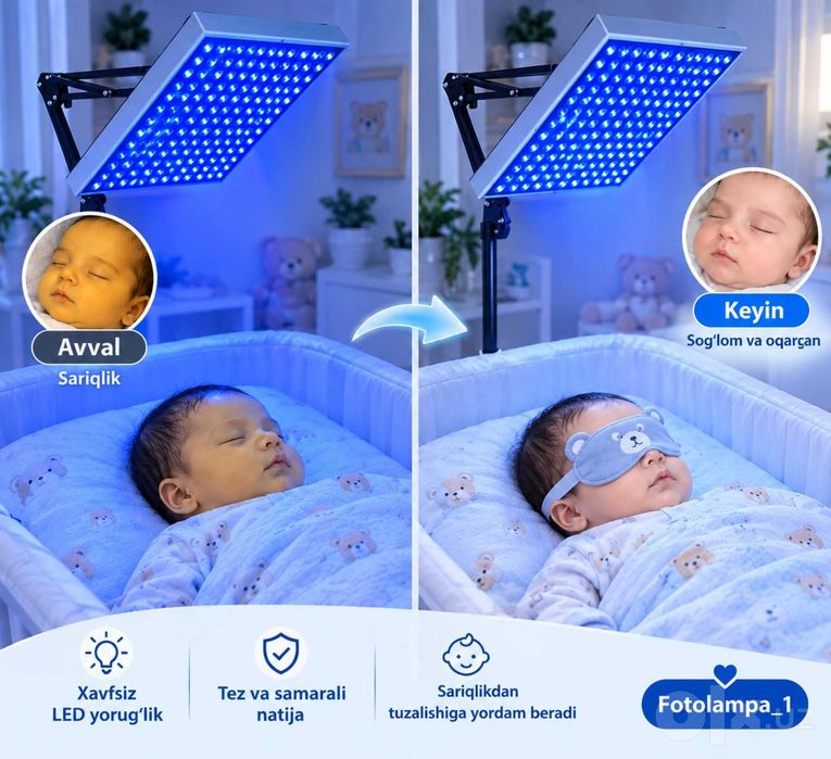 Fotolampa - chaqaloq uchun xavfsiz yorug'lik terapiyasi,Фотолампа куез