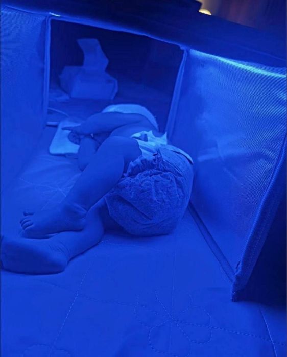 Лампа от желтушки