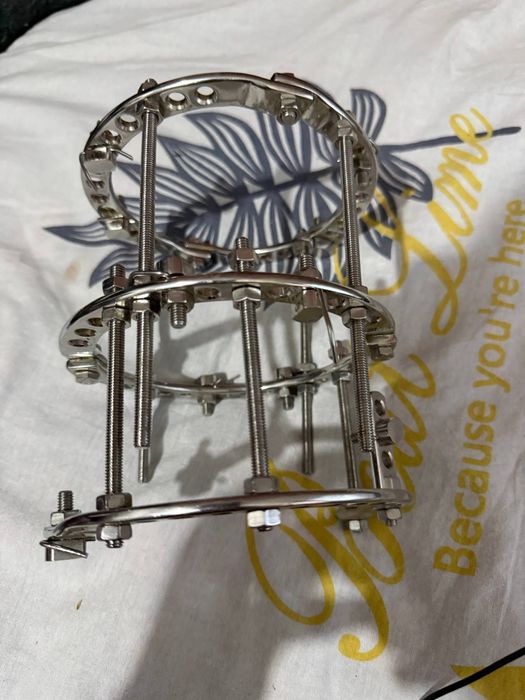 Аппарат илизарова пара, apparat ilizarova