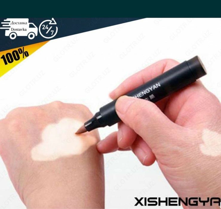 vitiligo flomaster oq do’g’lar uchun