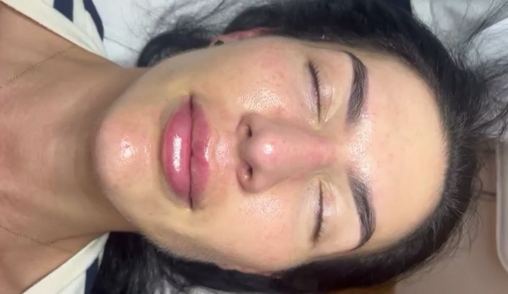 HydraFacial profesional – curățare profundă și hidratare intensă