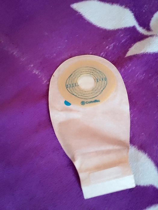 Vanda Pungi colostoma