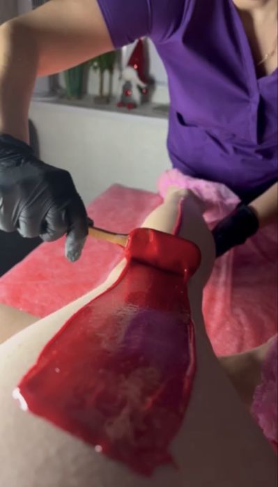 Эластомерная депиляция