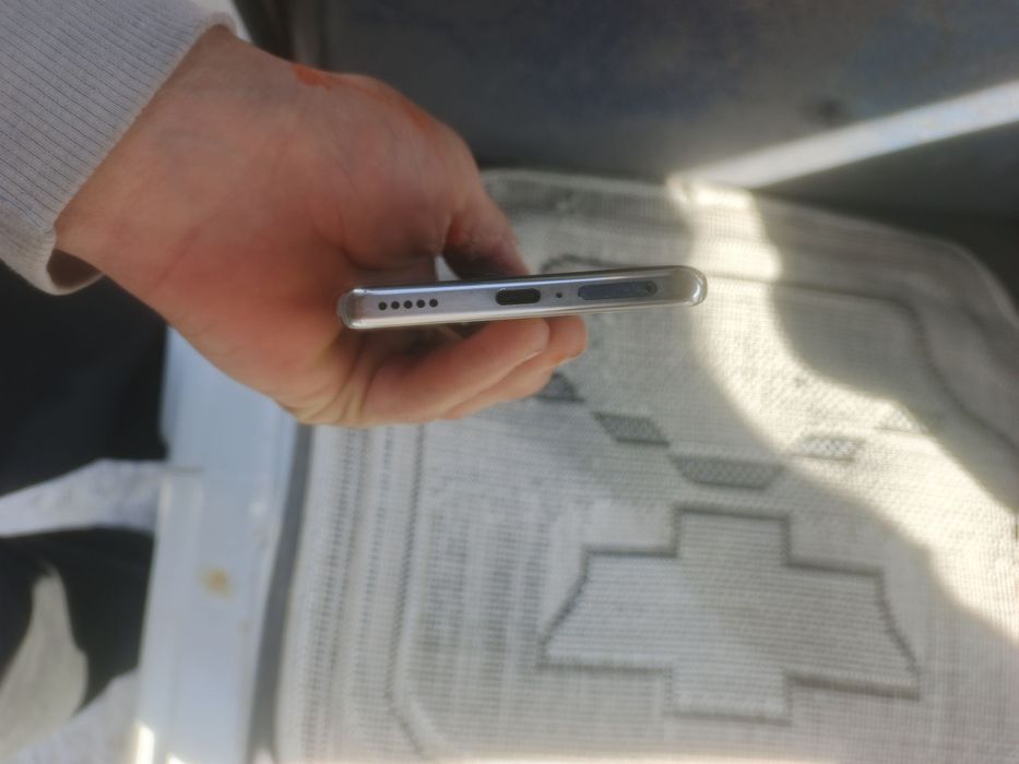 Honor x9b sotiladi holati yaxw 8/256 tali srochna sotiladi