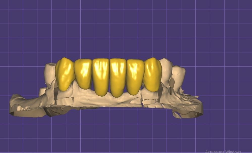 Практика для зубных техников