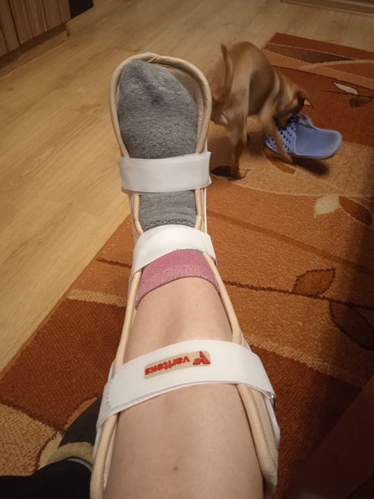 Ботуш за счупена кост на ходилото