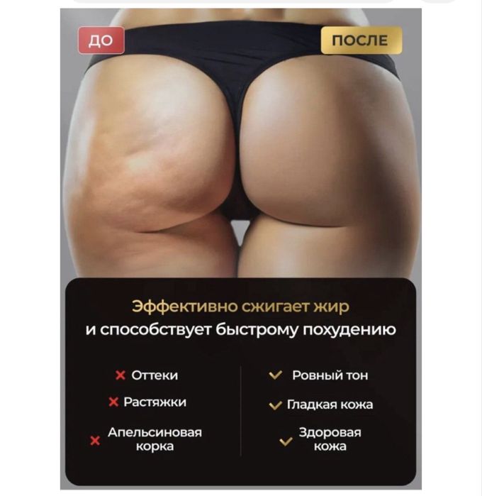 Массажер антицеллюлитный