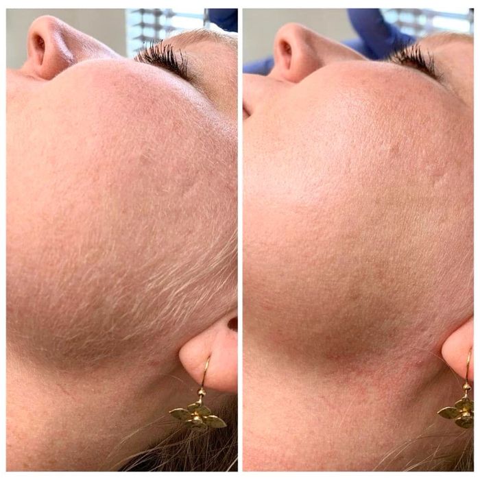 Услуги шугаринга с выездом