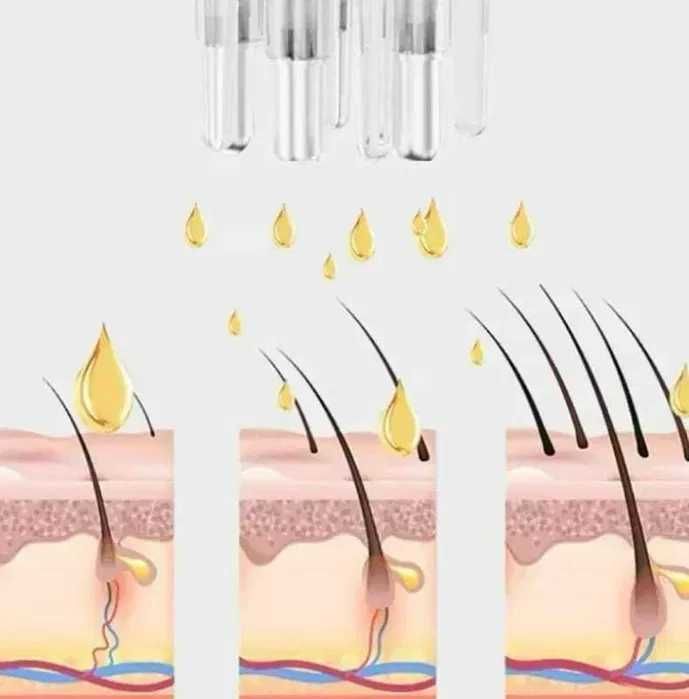 Апликатор/ масажор за масло за скалп/ коса