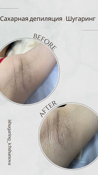Шугаринг выезд на дом 1000 тг