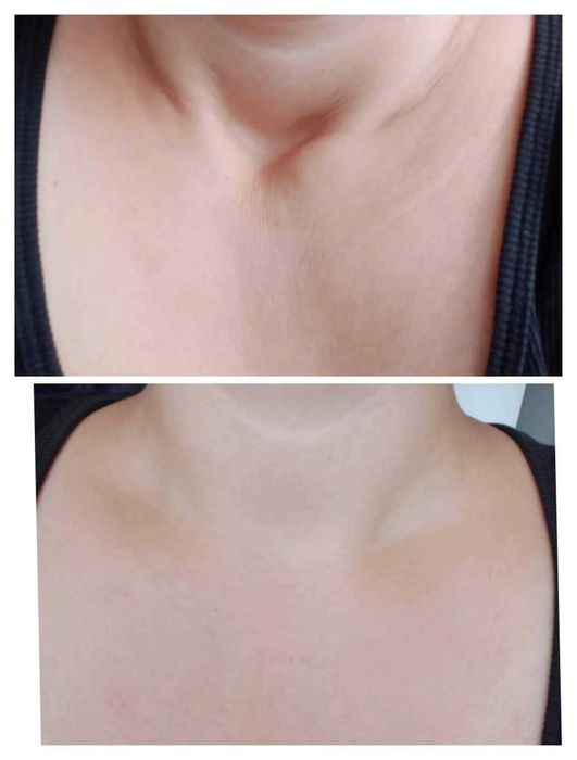 Retinol - козметика за лице против стареене