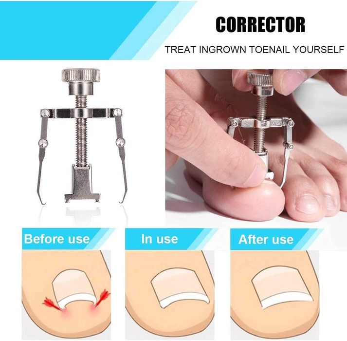 Trusa Manichiura Pedichiura Profesionala Unghii Incarnate 6 Piese Inox