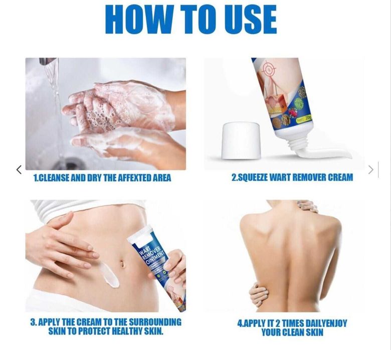 Крем за премахване на брадавици и мазоли