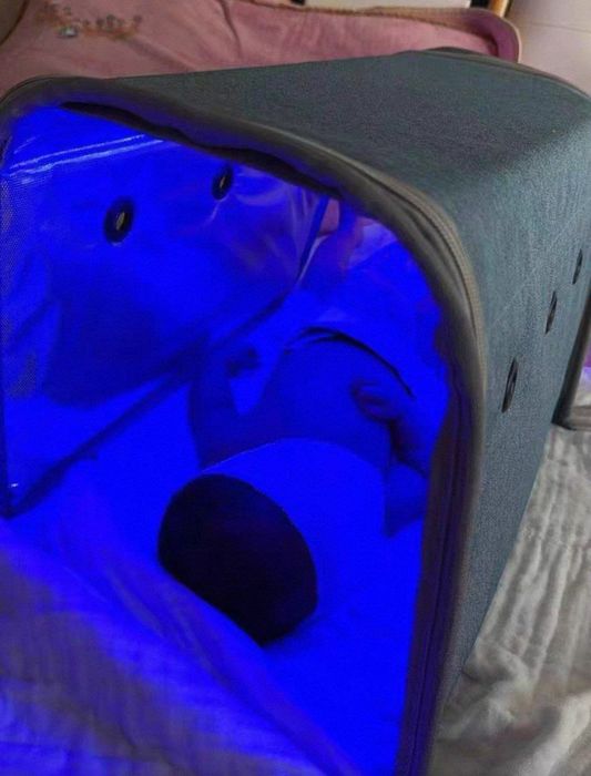 Фотолампа. Фототерапия.Fotolampa. 100 000 СУМ