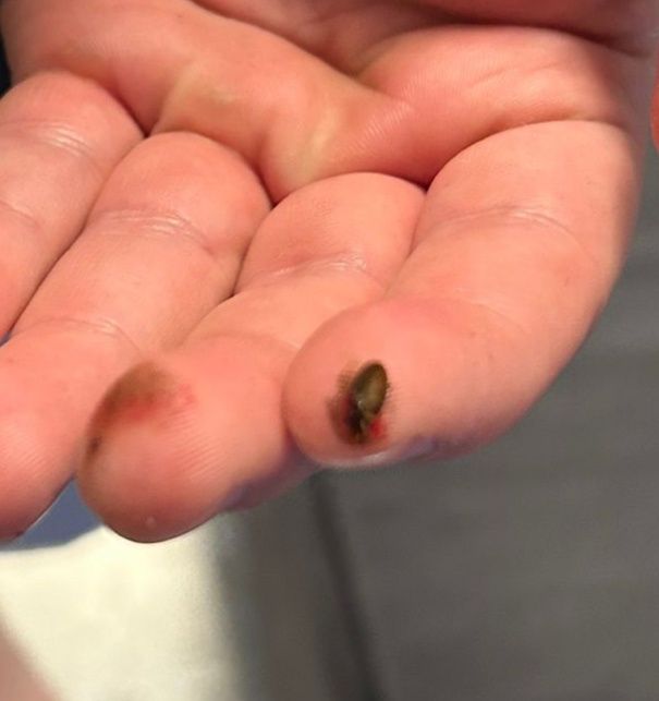 Dezinsecție Plosnite de pat dezinsecție cu aparat profesional cu abur