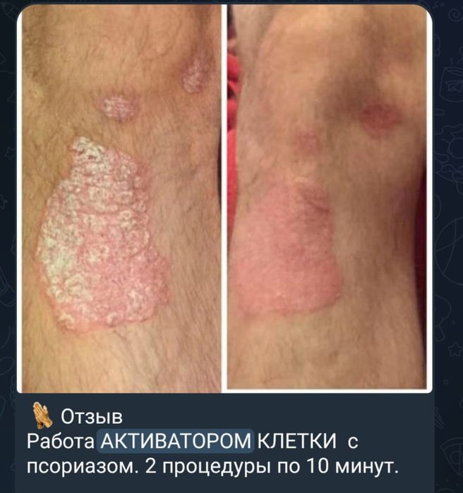 Продаётся Активатор Клеток