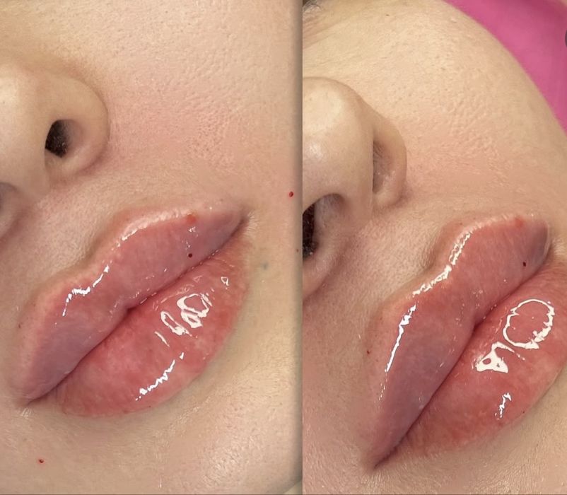 Kosmetolog +Bio Texnika Rastushovka