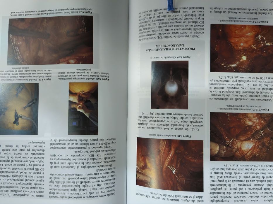 Tratat de Chirurgie Uro Oncologie vol. IX Ed. 2-a. Ioan Coman,