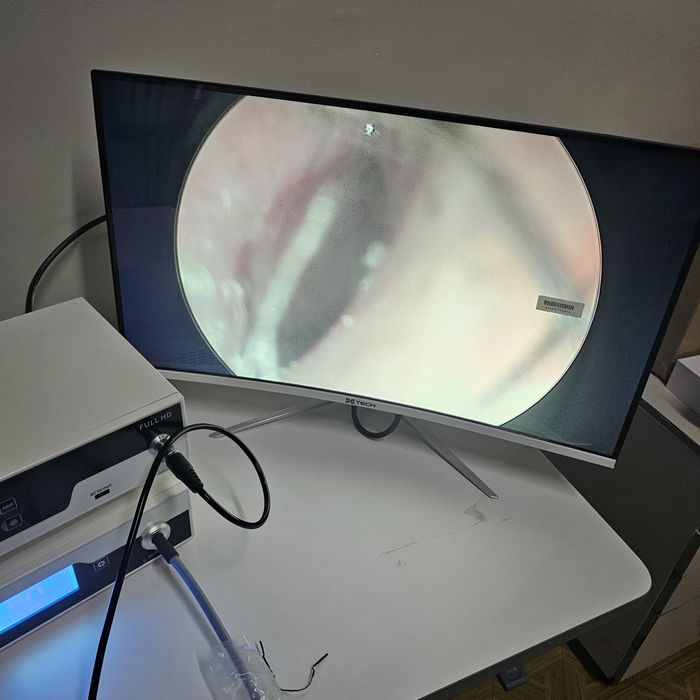 Lor endoskop full HD