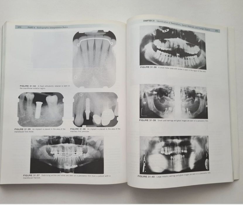 Dental Radiography - Iannucci