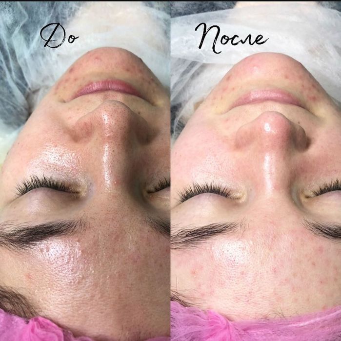 Прокол ушей.Чистка лица.Шугаринг.Ламинирование,наращивание ресниц