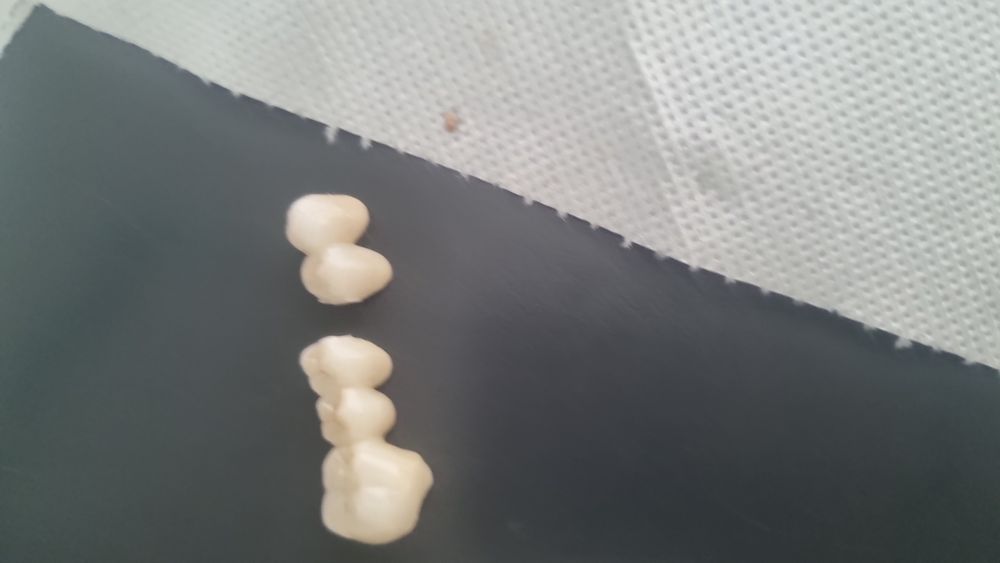 Vând pătuț ptr bebe in stare buna,puțin folosit, cu saltea de cocos cu husa detașabilă si scaun de masă bebe