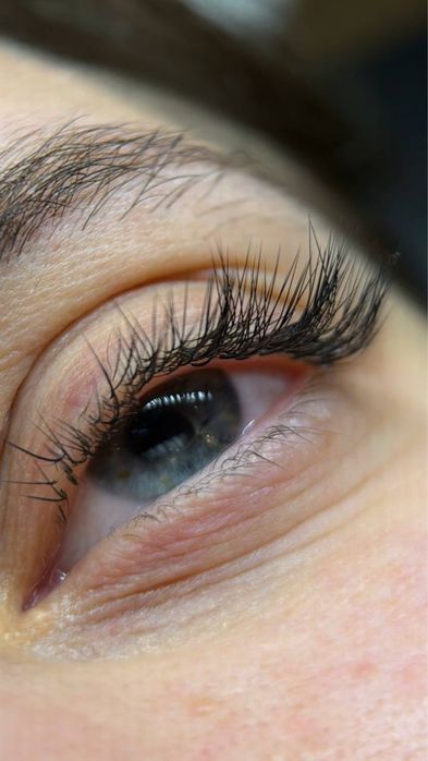 Gene fir cu fir Otopeni